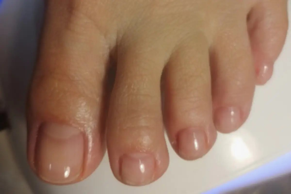 “For the First Time in Years… My Nails Look Normal Again”